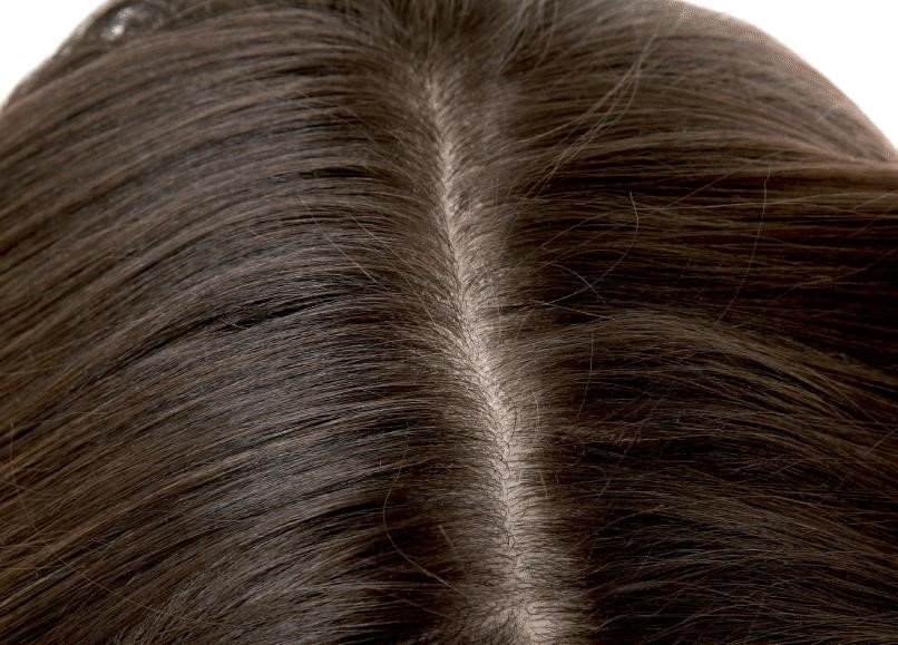 About Hair Scalp Treatment 3