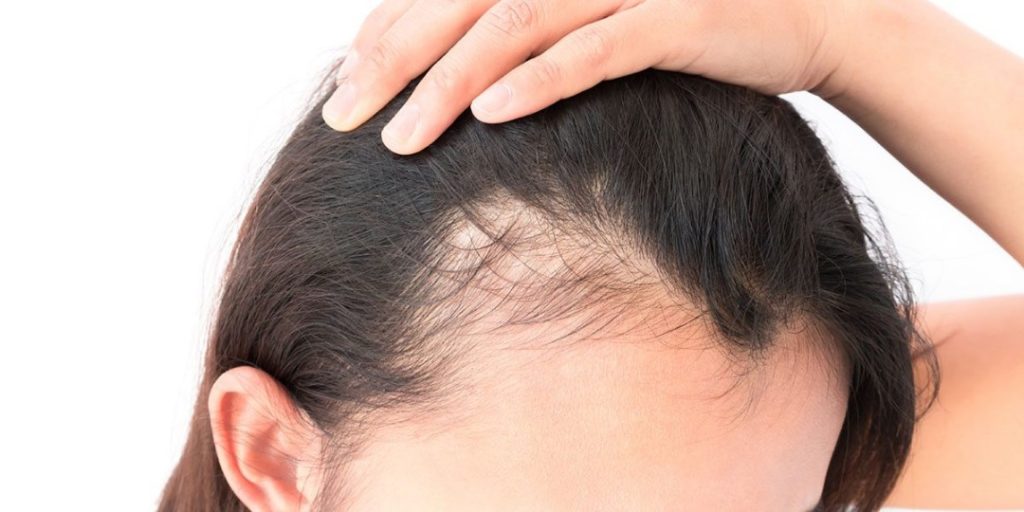 About Hair Scalp Treatment 1